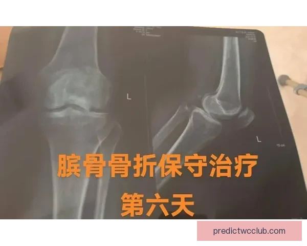 穆迪受伤可能影响下赛季复出队医称髌骨肌腱问题严重